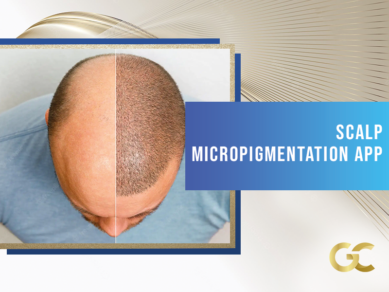 Scalp Micropigmentation App Gold City Best Hair Transplant Turkey