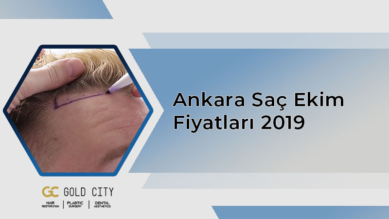 ankara-sac-ekim-fiyatlari-2019