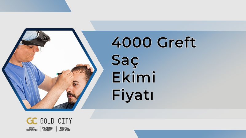 4000-greft-sac-ekimi-fiyati