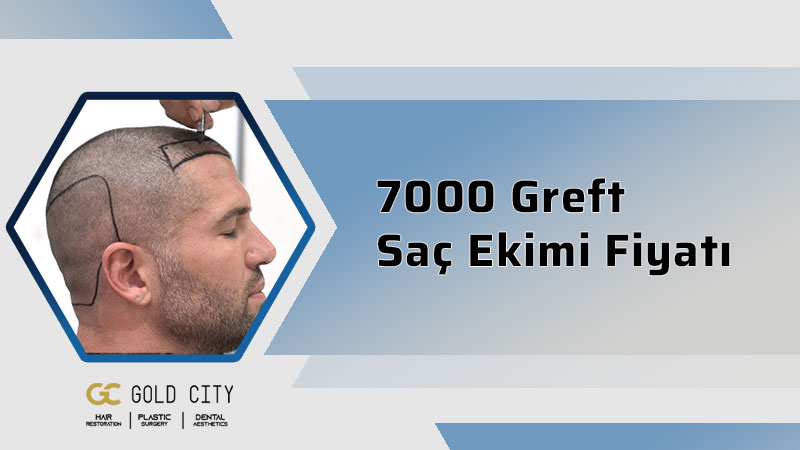 7000-greft-sac-ekimi-fiyati