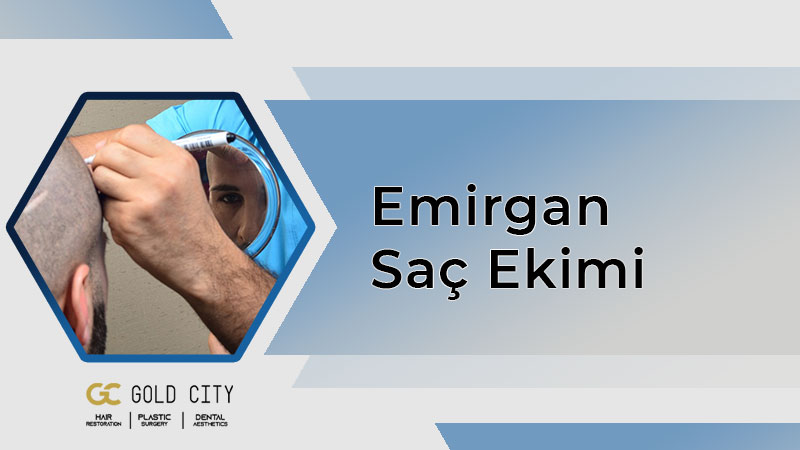 emirgan-sac-ekimi